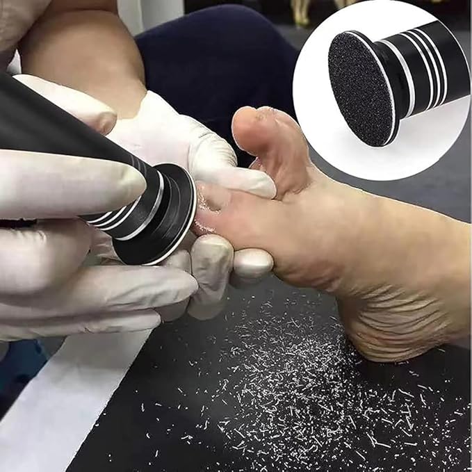 Rechargeable Foot File